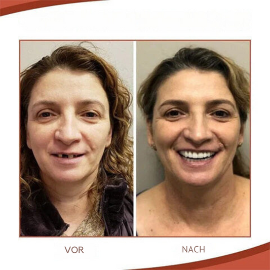 Thomasequestrian | Biocompatible Prosthesis Set for Natural Smile & Comfort